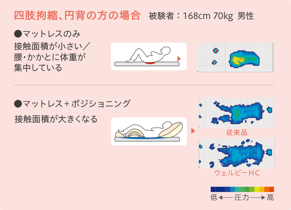 αPLA アルファプラ｜ウェルピーＨＣ（体位変換器）